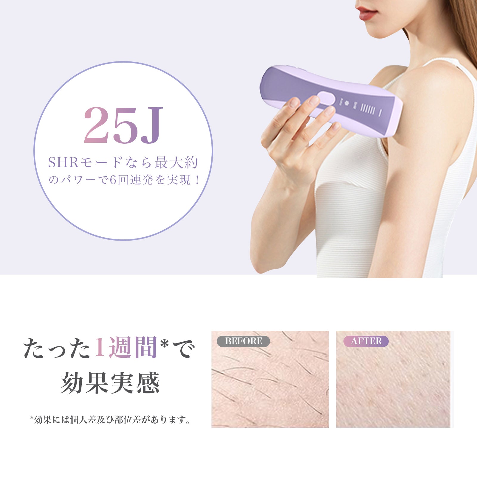 YETE 脱毛器 家庭用脱毛器 全身ムダ毛処理 IPL光脱毛器 家庭